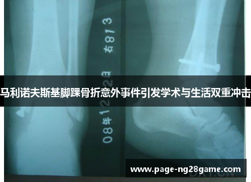 马利诺夫斯基脚踝骨折意外事件引发学术与生活双重冲击 马利诺夫斯基脚踝骨折意外事件引发学术与生活双重冲击